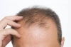 Best Hair Transplant Clinic in Delhi India Avatar